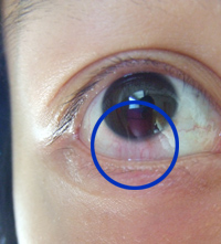 眼睛1.jpg 眼睛1.jpg