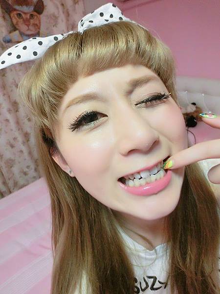 *分享*極緻美學牙醫。冷光美白讓我笑的更有信心