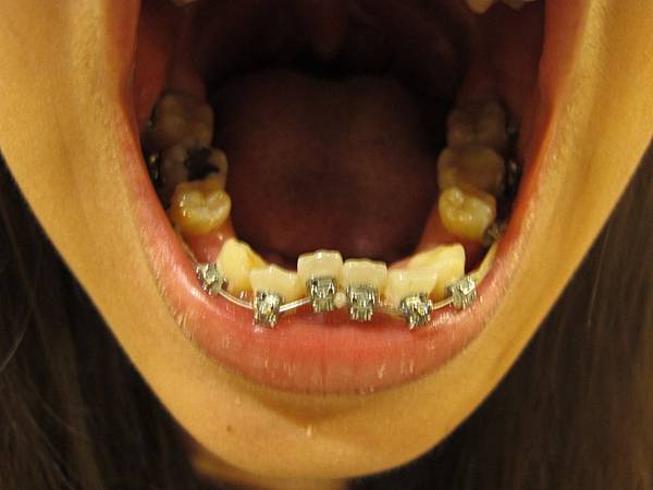 IMG_9565.jpg IMG_9565.jpg