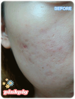 anigif1.gif anigif1.gif