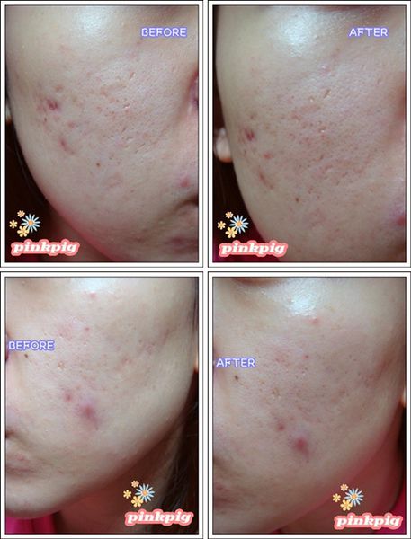 DSC00002-tile.jpg DSC00002-tile.jpg