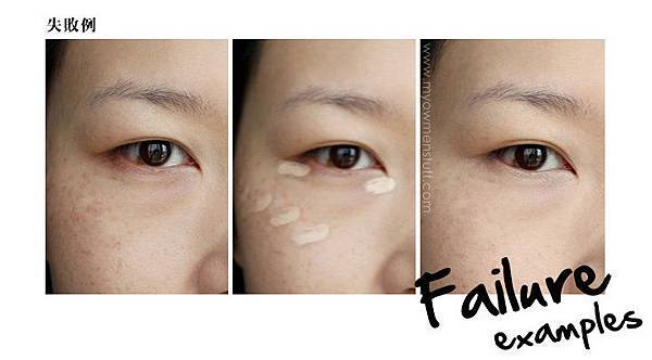失敗例 失敗例