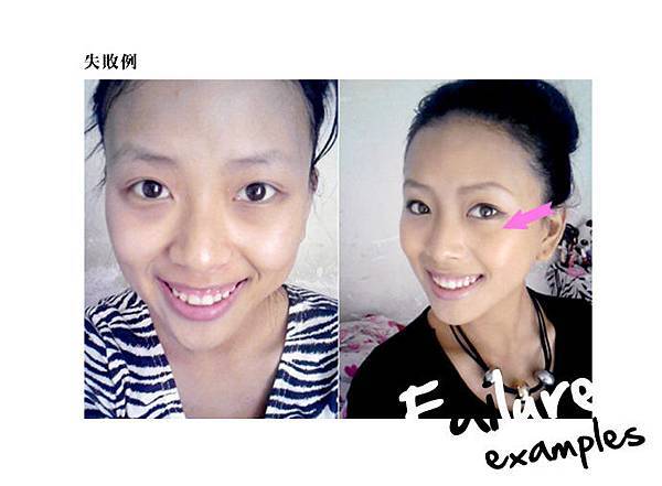 失敗例2 失敗例2