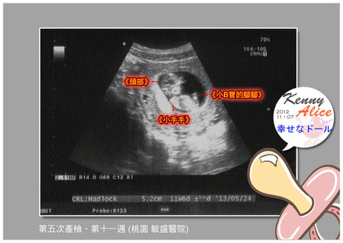 【孕事】♥ 懷孕十月 ♥ 第十一週 換到 桃園-敏盛 【孕事】♥ 懷孕十月 ♥ 第十一週 換到 桃園-敏盛