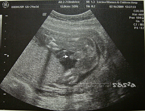 本來不給看現在很愛露