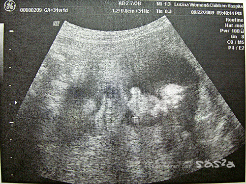 30W1D鼻子像拔鼻 30W1D鼻子像拔鼻