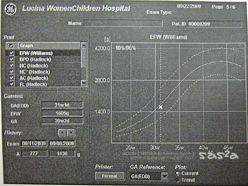 30W1D生長曲線 30W1D生長曲線