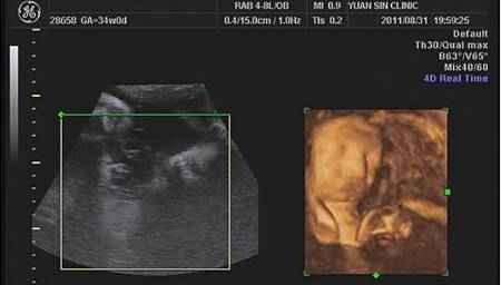 小乖34W超音波4D.jpg 小乖34W超音波4D.jpg