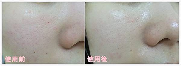 使用前後1