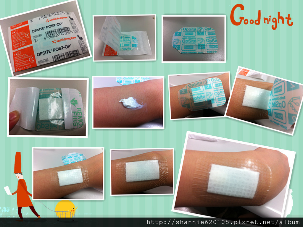 英商史耐輝 Opsite Post-op防水傷口護墊
