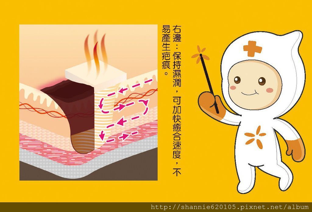 傷口濕潤圖示 傷口濕潤圖示