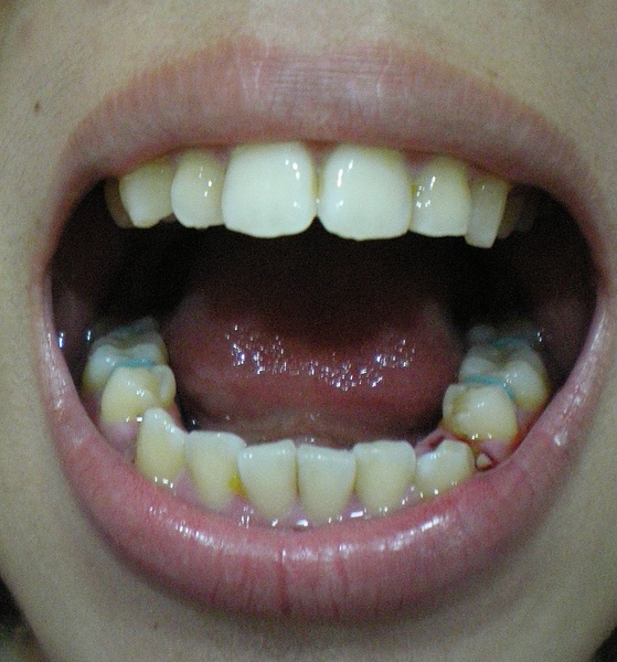 IMGP0910.JPG IMGP0910.JPG