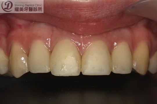 v49