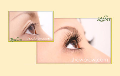 濃密型-接植前後