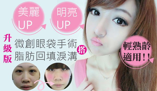 眼袋1 眼袋1