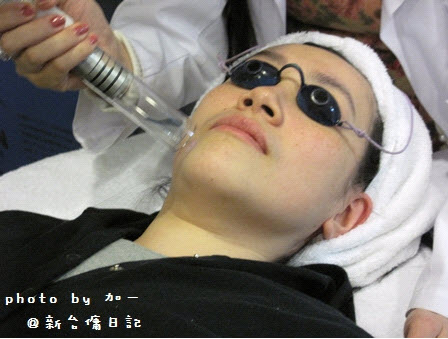 【引用】部落客加一ｘ新竹悠美－年前進廠保養C9柔膚雷射搭配脈衝光淡斑