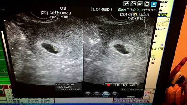 10551769_10202388498062428_493354204_n