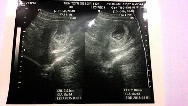 10588593_10202484164654033_1963981066_n