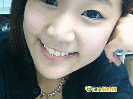 黃牙笑起來好糗！　愛喝茶和咖啡惹禍