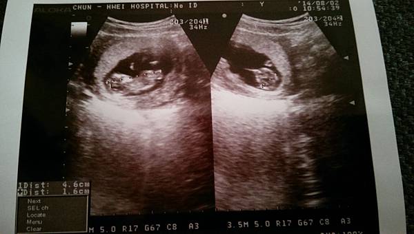 1030802_第一次產檢 1030802_第一次產檢