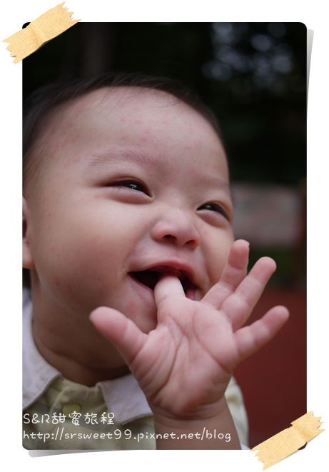 10M玫瑰疹 124.JPG