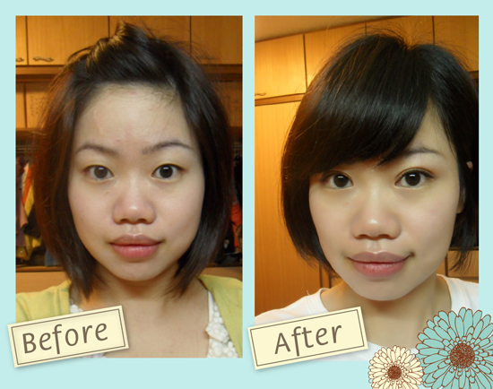 星和台北_雙眼皮_Ada01 星和台北_雙眼皮_Ada01