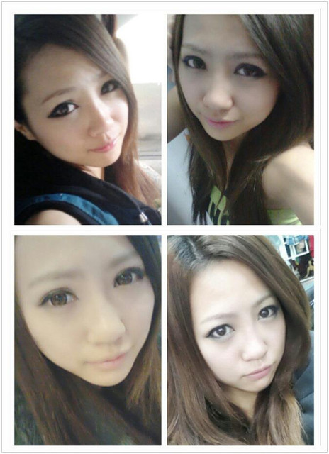 星和台北_雙眼皮_杞孟衿醫師16 星和台北_雙眼皮_杞孟衿醫師16