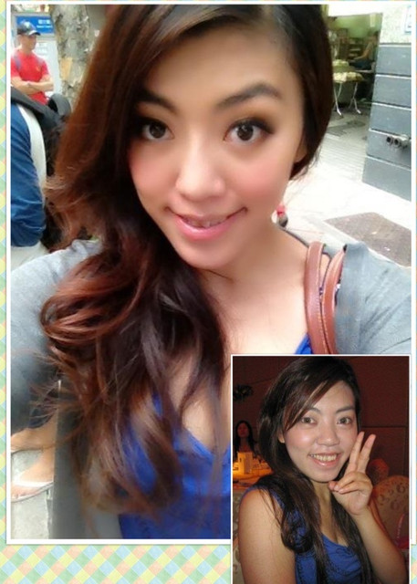 星采大安_雙眼皮_邱大睿院長01 星采大安_雙眼皮_邱大睿院長01