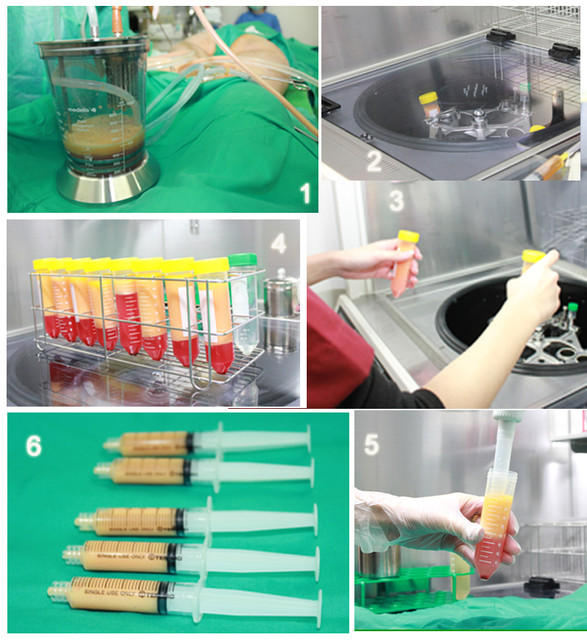 星采大安_自體脂肪胸部填補_邱大睿院長12 星采大安_自體脂肪胸部填補_邱大睿院長12