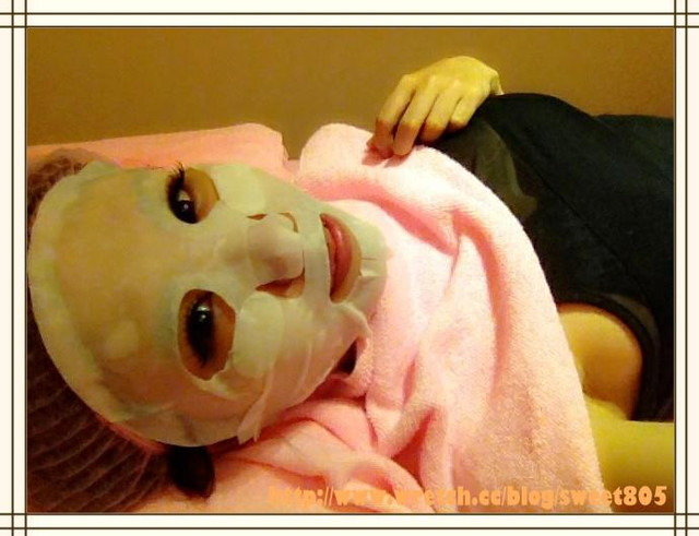 高雄醫美星和診所_杏仁酸煥膚09 高雄醫美星和診所_杏仁酸煥膚09