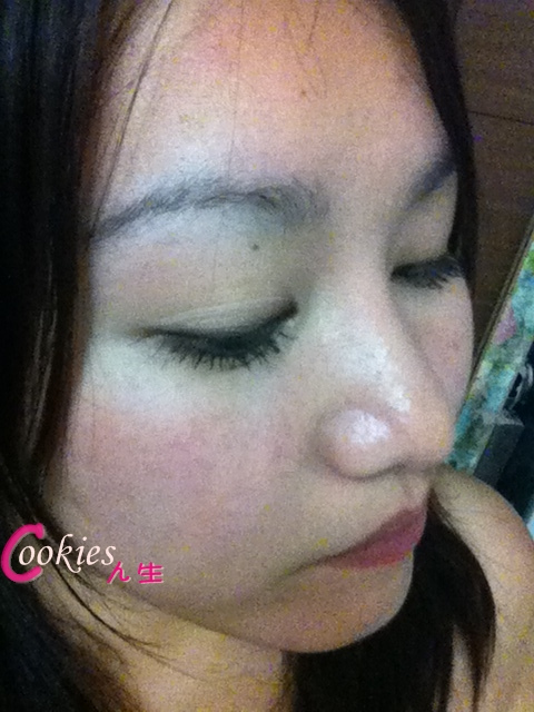 星和台北_韓式隆鼻/三段式隆鼻_邱大睿醫師17 星和台北_韓式隆鼻/三段式隆鼻_邱大睿醫師17