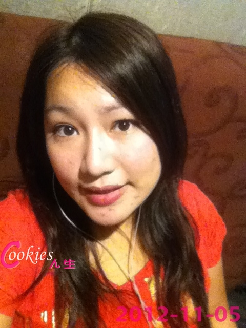 星和台北_韓式隆鼻/三段式隆鼻_邱大睿醫師18 星和台北_韓式隆鼻/三段式隆鼻_邱大睿醫師18