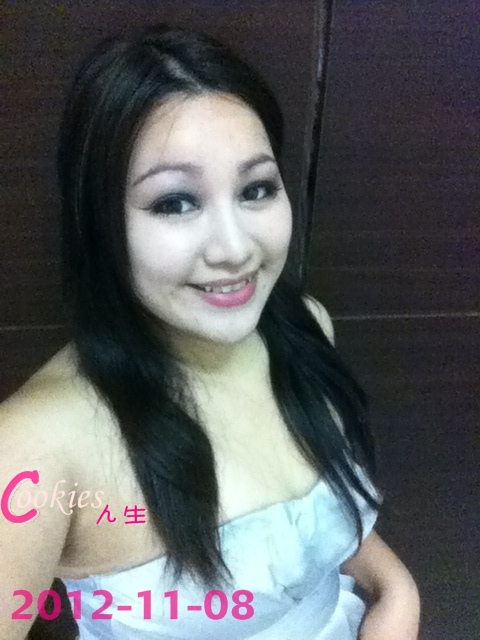 星和台北_韓式隆鼻/三段式隆鼻_邱大睿醫師21 星和台北_韓式隆鼻/三段式隆鼻_邱大睿醫師21