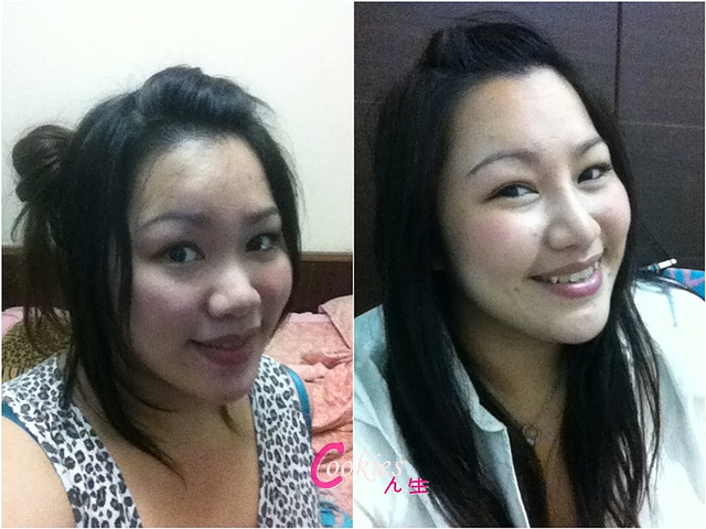 星和台北_韓式隆鼻/三段式隆鼻_邱大睿醫師28 星和台北_韓式隆鼻/三段式隆鼻_邱大睿醫師28