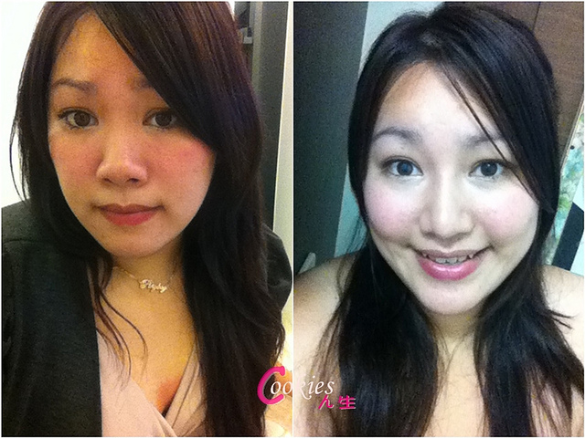 星和台北_韓式隆鼻/三段式隆鼻_邱大睿醫師29 星和台北_韓式隆鼻/三段式隆鼻_邱大睿醫師29