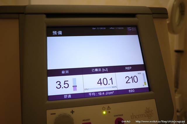 星采古亭_電波拉皮_Chaio17 星采古亭_電波拉皮_Chaio17