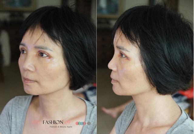 星和台北_雙眼皮_杞孟衿醫師22 星和台北_雙眼皮_杞孟衿醫師22