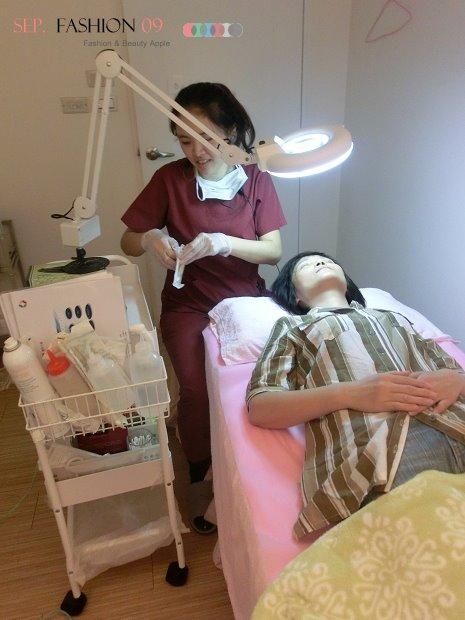 星和台北_雙眼皮_杞孟衿醫師24 星和台北_雙眼皮_杞孟衿醫師24