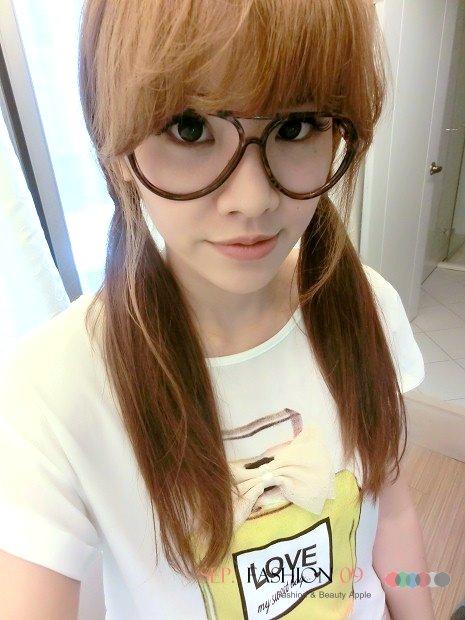 星和台北_雙眼皮_杞孟衿醫師25 星和台北_雙眼皮_杞孟衿醫師25