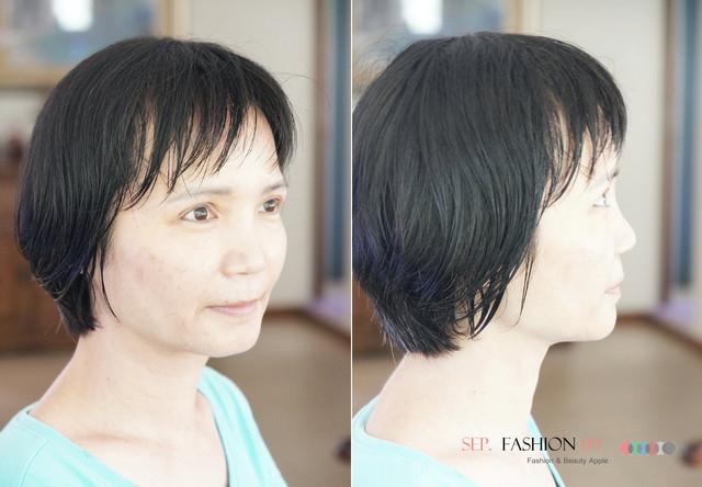 星和台北_雙眼皮_杞孟衿醫師31 星和台北_雙眼皮_杞孟衿醫師31