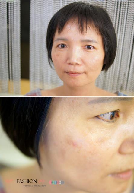 星和台北_雙眼皮_杞孟衿醫師33 星和台北_雙眼皮_杞孟衿醫師33