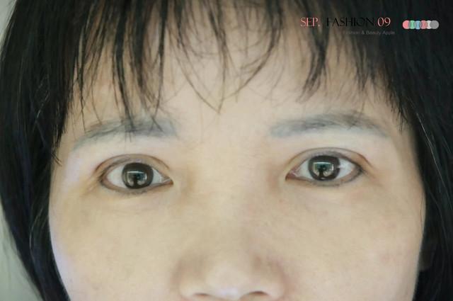 星和台北_雙眼皮_杞孟衿醫師35 星和台北_雙眼皮_杞孟衿醫師35