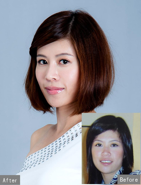 星采大安_韓式隆鼻/三段式隆鼻_邱大睿醫師01 星采大安_韓式隆鼻/三段式隆鼻_邱大睿醫師01