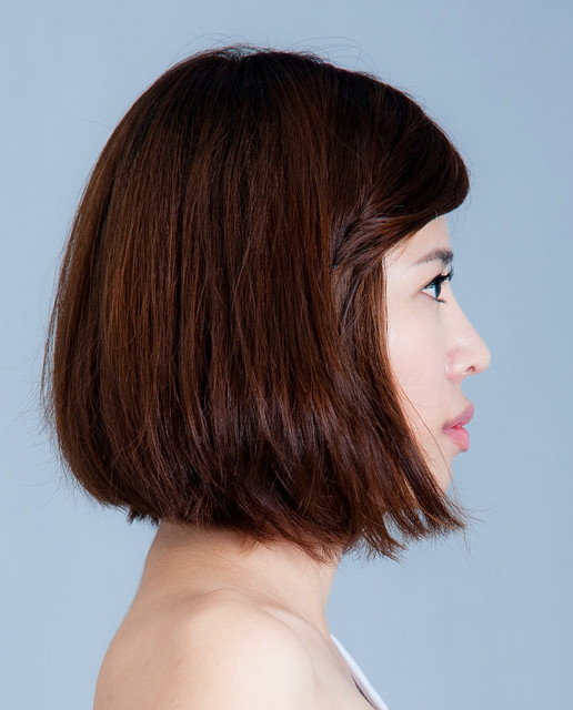 星采大安_韓式隆鼻/三段式隆鼻_邱大睿醫師07 星采大安_韓式隆鼻/三段式隆鼻_邱大睿醫師07