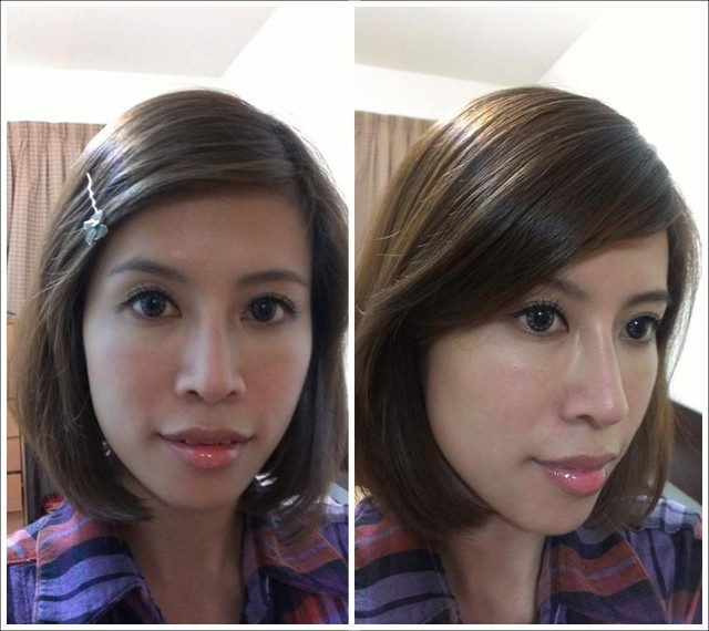 星采大安_韓式隆鼻/三段式隆鼻_邱大睿醫師08 星采大安_韓式隆鼻/三段式隆鼻_邱大睿醫師08