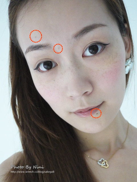 星和台中_雷射除痣_Nini01 星和台中_雷射除痣_Nini01