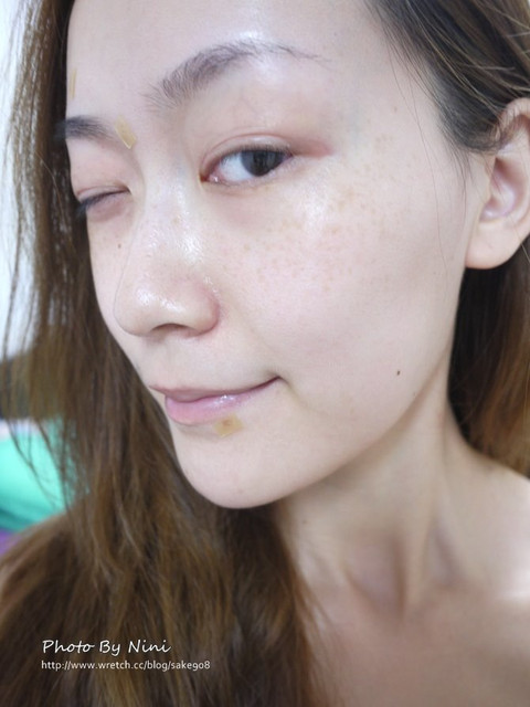 星和台中_雷射除痣_Nini25