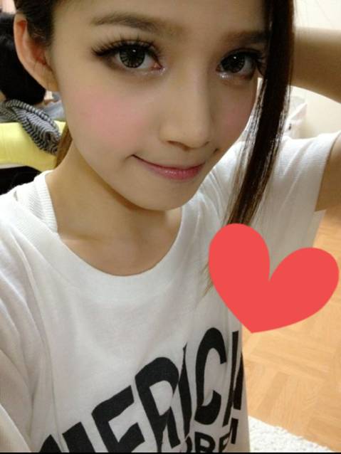 星和台北_韓式隆鼻.開眼頭_邱大睿醫師19 星和台北_韓式隆鼻.開眼頭_邱大睿醫師19