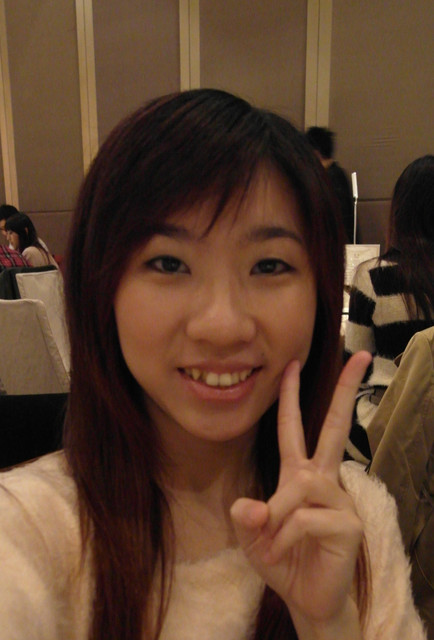 星和台北_雙眼皮_杞孟衿醫師03 星和台北_雙眼皮_杞孟衿醫師03