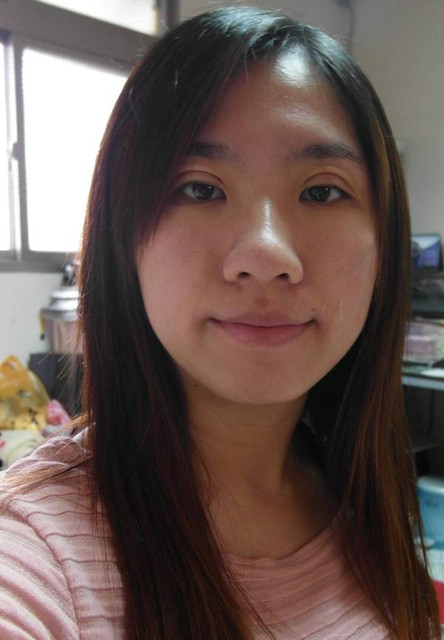 星和台北_雙眼皮_杞孟衿醫師09 星和台北_雙眼皮_杞孟衿醫師09